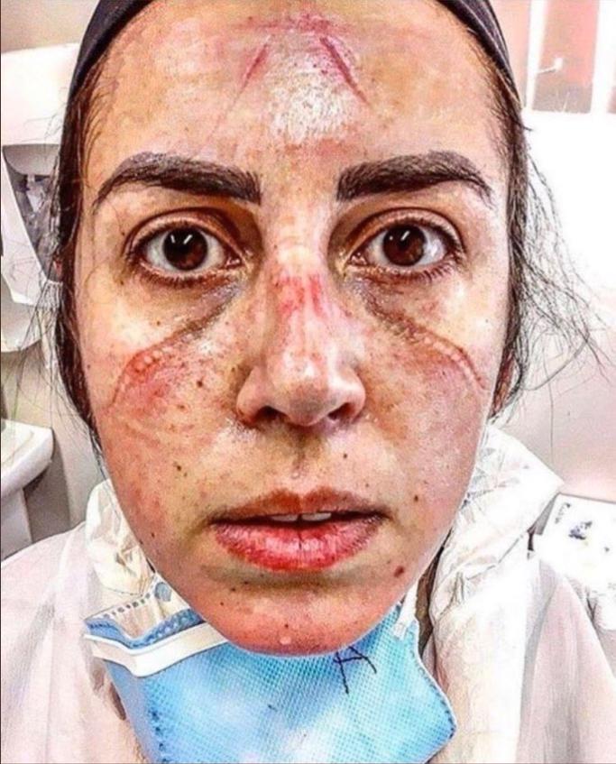 Yok artık; Antalya'da tatilciler maskeyle güneşlendi. Tatili böyle geçirmek mantıklı mı?