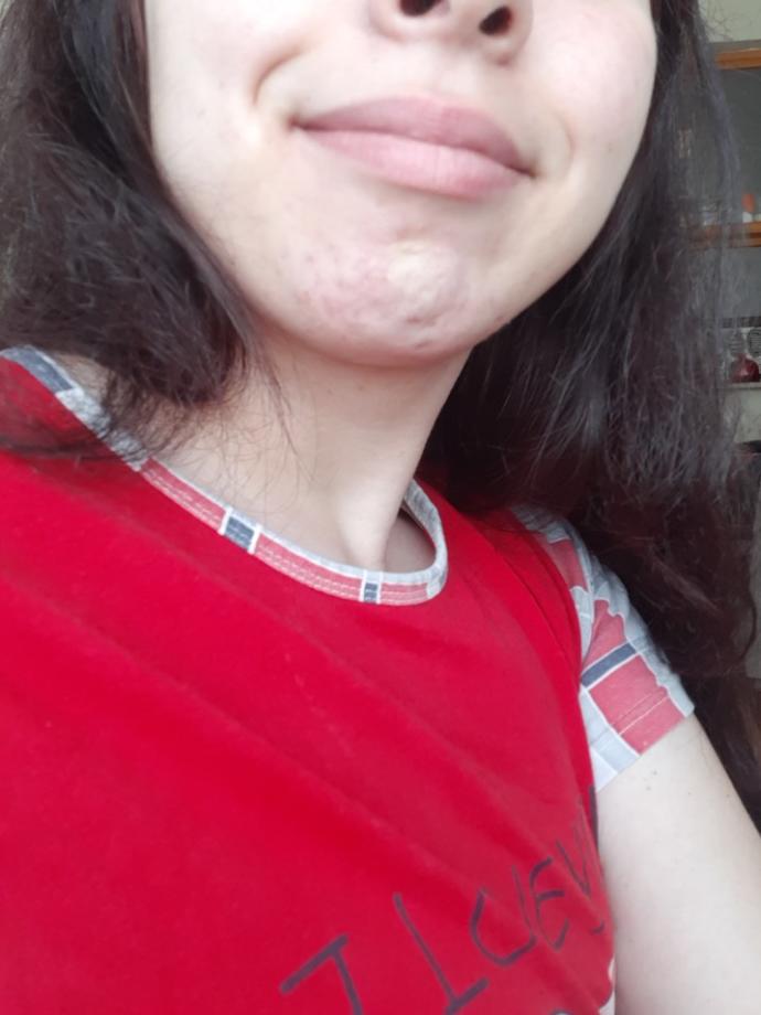 Renkli gözlü kişiler mi, gamzeli kişiler mi daha çekicidir?