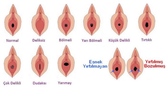 Bakire olup olmadığımı nasıl anlarım?