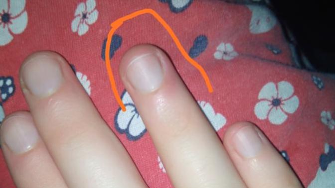 Tırnağımı çok mu kısa kesmişim?