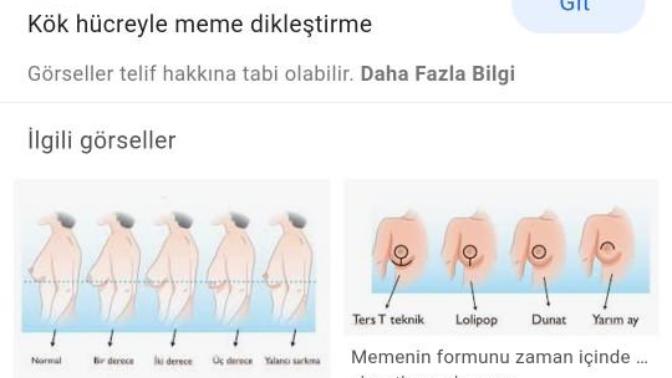 Göğüs sarkması sorunsalı?