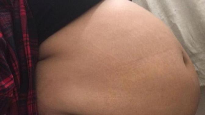 Göbeğim çok büyük chloe ting challenge bende işe yarar mı?