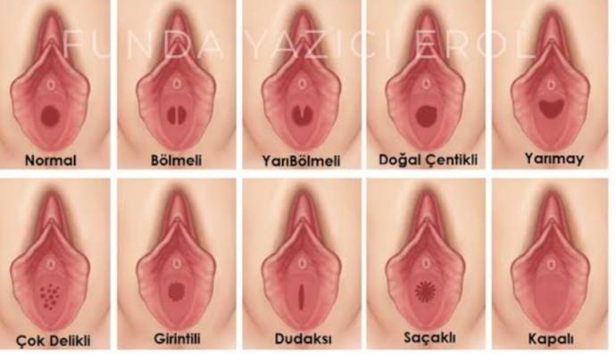 İlk gece karınız bakire ama kan gelmese tepkiniz ne olurdu?