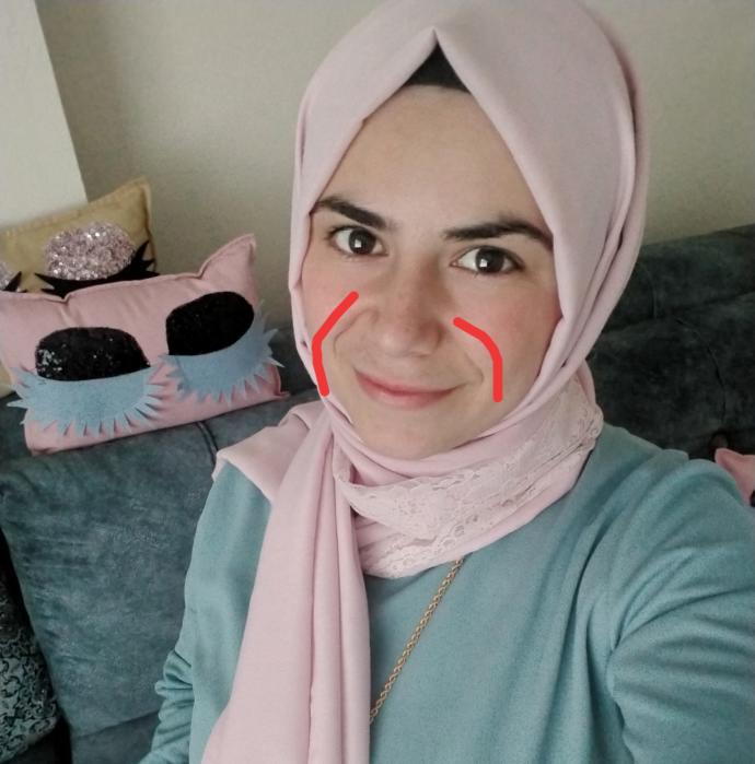 Yüzümdeki ince çizgiler çok mu yaşlı gösteriyor?