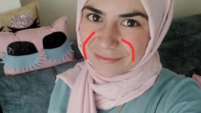 Yüzümdeki ince çizgiler çok mu yaşlı gösteriyor?