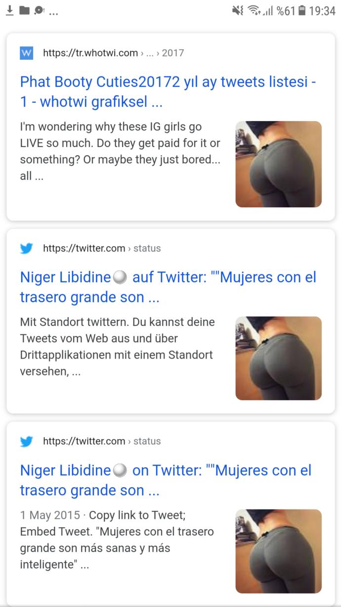 Kalçamda böyle bir çizgi var bunu nasıl yok ederim?