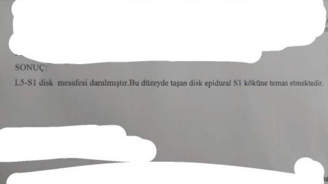 Bel fıtığının kolay  bir  tedavisi var mı?