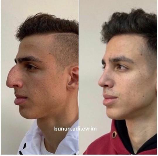 Türkiye estetik açısından diğer ülkelere göre daha mı iyi?