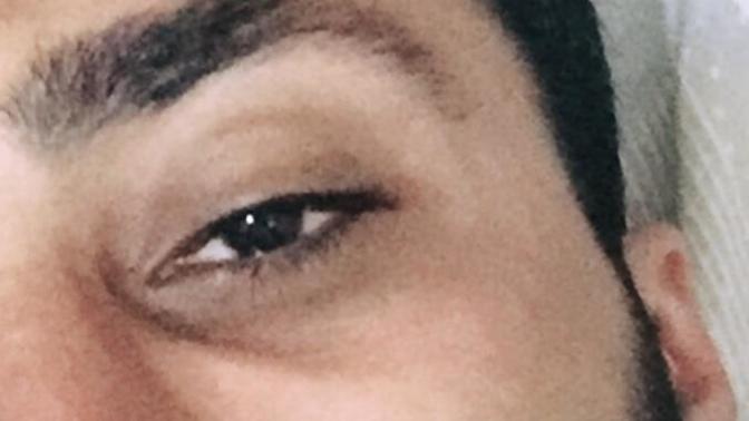 Göz altlarım çökük ve mor bana etkili krem falan söyler misiniz?