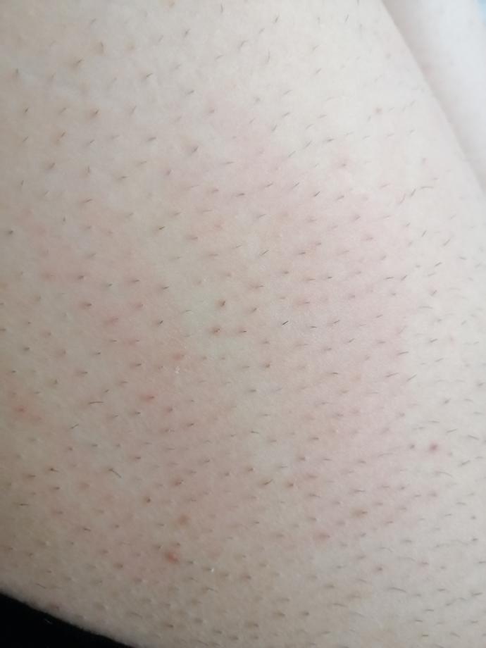 Üst bacaklar bu şekilde kıllı kızlar ben mi çok kıllıyım herkes mi böyle 😔😔😔😔?