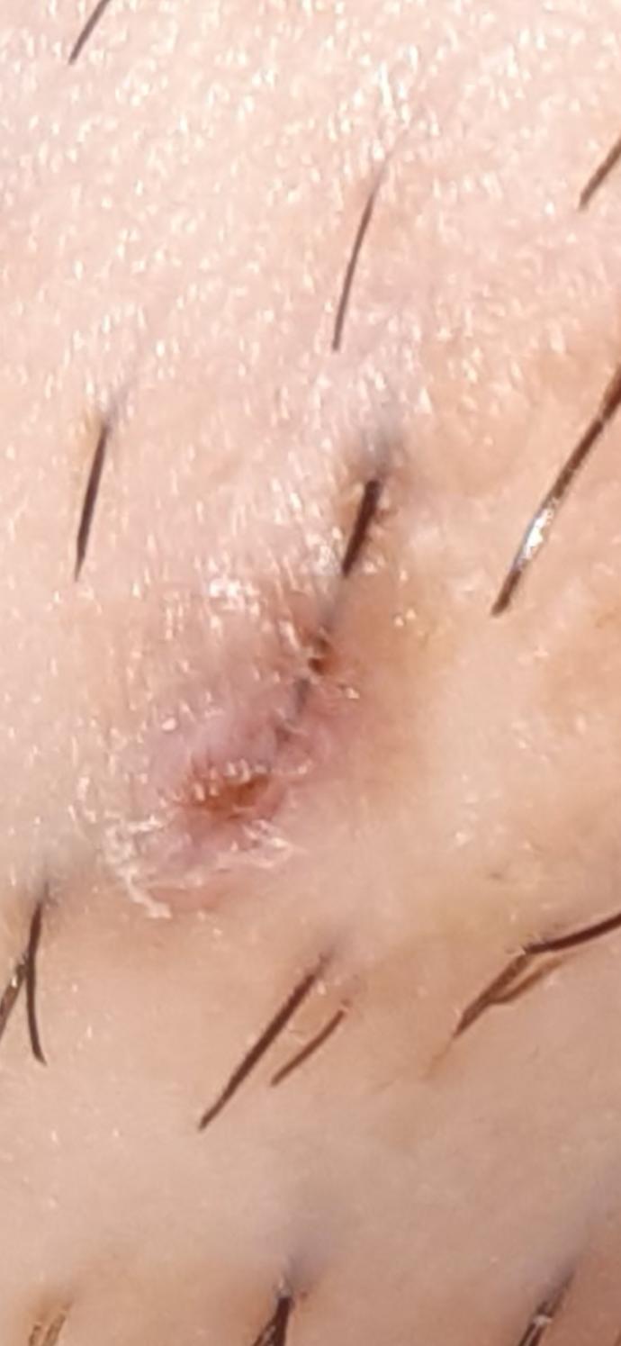 Bu kıl dönmesi mi içinde kıl mı var?
