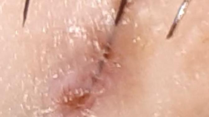 Bu kıl dönmesi mi içinde kıl mı var?
