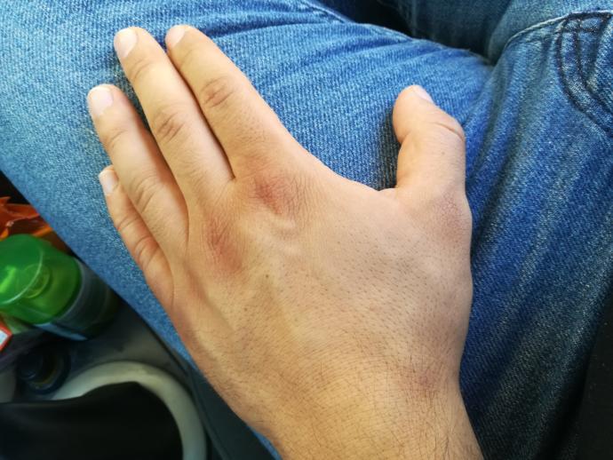 Erkekler eli böyle olan var mı?