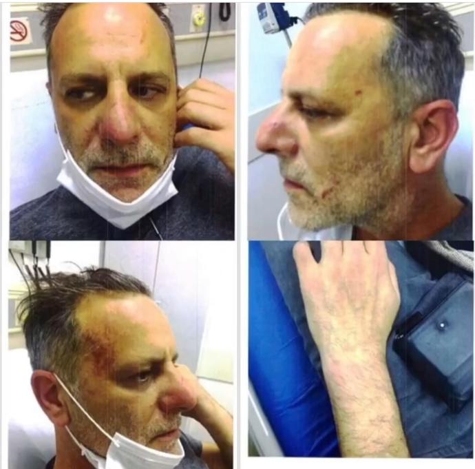 Ozan Güvenin de darp raporu ortaya çıktı, ne düşünüyorsunuz?