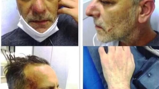Ozan Güven'in de darp raporu ortaya çıktı, ne düşünüyorsunuz?