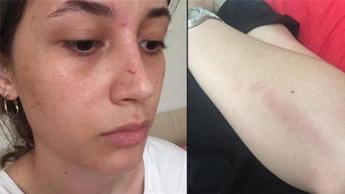 Şort giyen kıza "sen bunu giyemezsin" diyerek saldıran adam serbest bırakıldı. Bu tarz insanlar neden cezasız kalıyor?