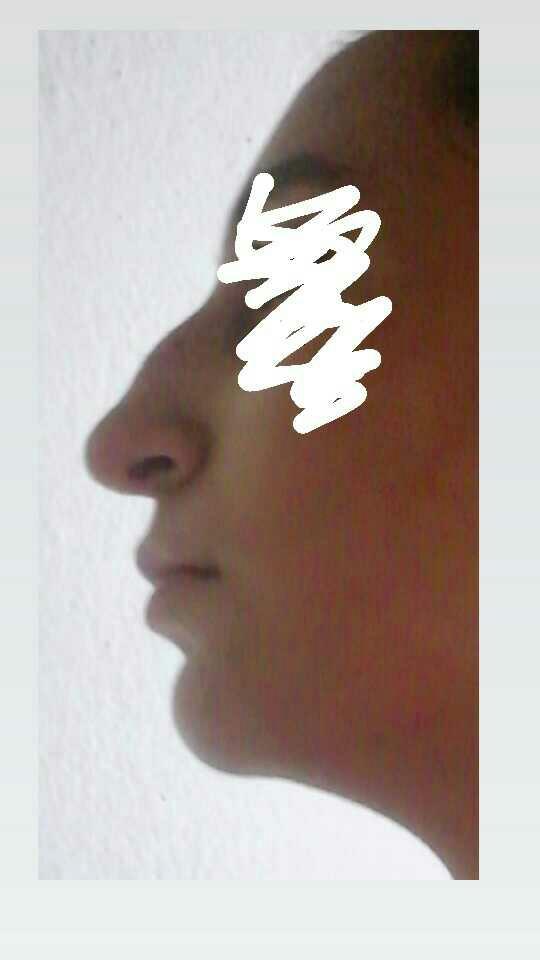 Burnum laz burnu gibi?