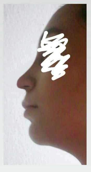 Burnum laz burnu gibi?