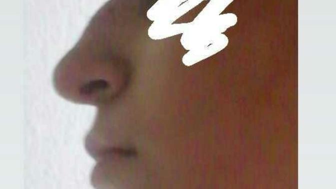 Burnum laz burnu gibi?