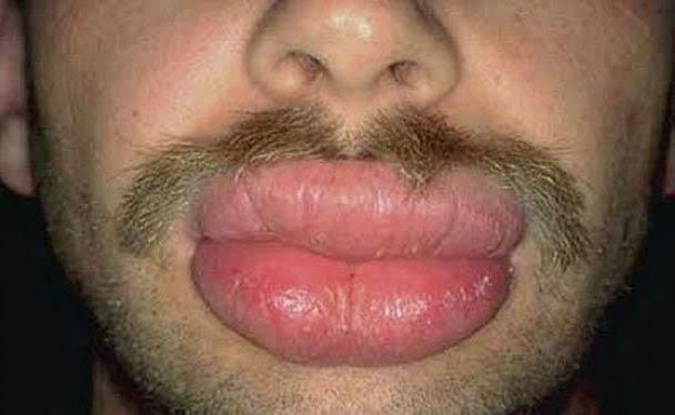 Bir erkeğin alt dudağı mi? Üst dudağı mi cekici?