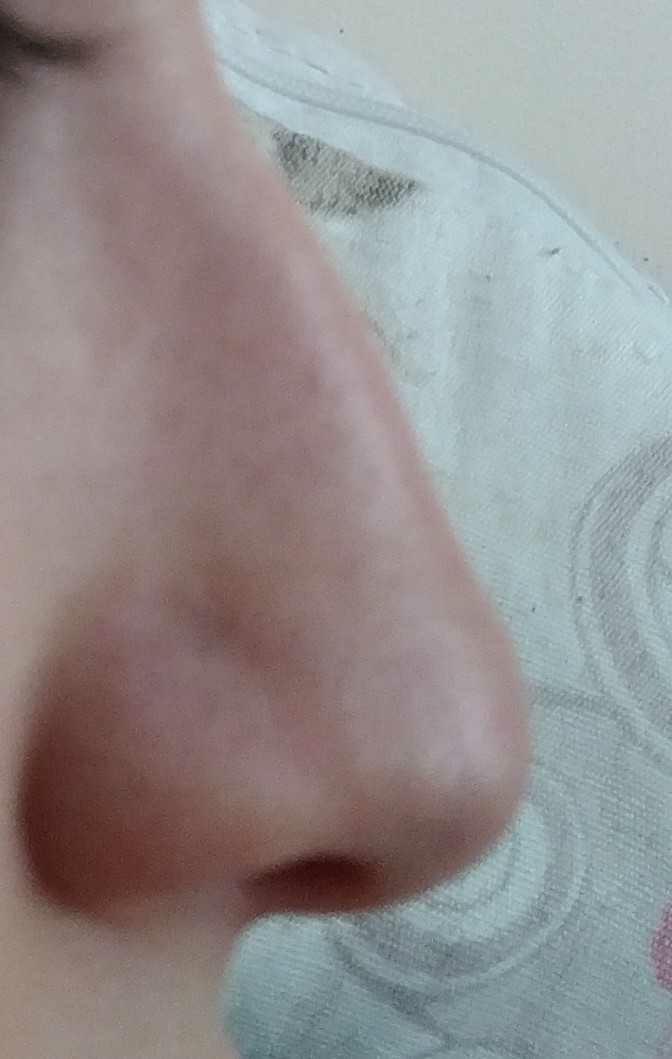 Bende takıntı oldu bakar mısınız burun estetiğine ihtiyacım var mı? Yaptıran varsa aşağıdaki sorularımi cevaplayabilir mi?