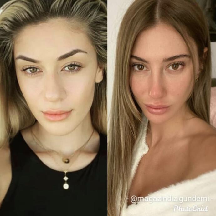 Şeyma Subaşı mı daha güzel Acunun sevgilisi Çağla mı sizce?