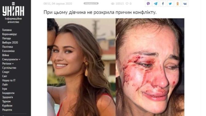 Ukraynalı model Daria Kyryliuk Türkiye de Dövülmesi Ukrayna Medyasında Yankı Buldu Siz Ne Düşünüyorsunuz?