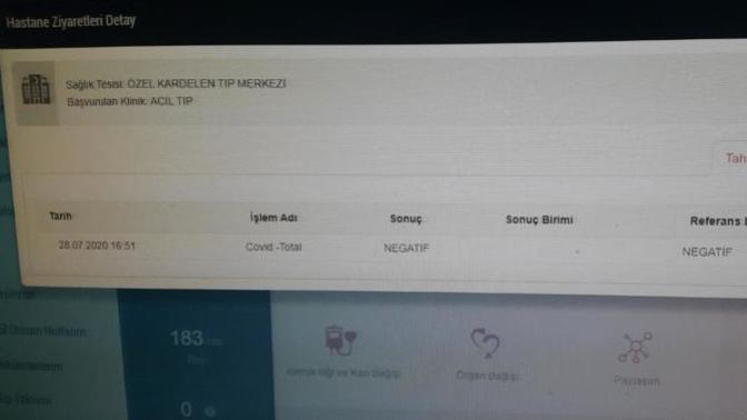 En son ne zaman Covid-19 testi oldunuz?