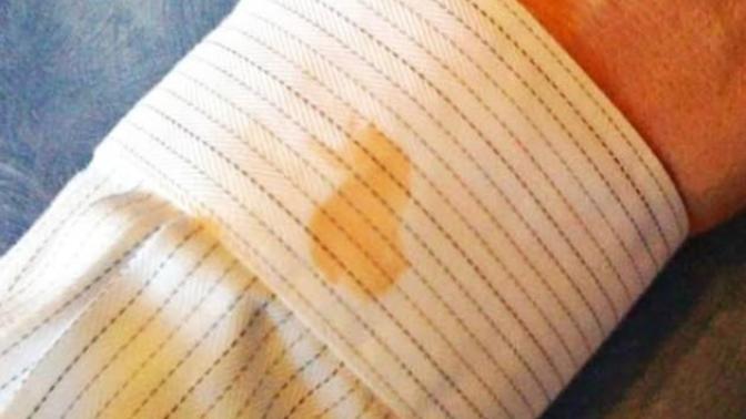 Kurumuş yağ lekesi kıyafetlerden nasıl çıkar?