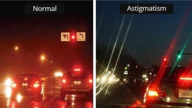 Astigmat nedir, neden oluşur?