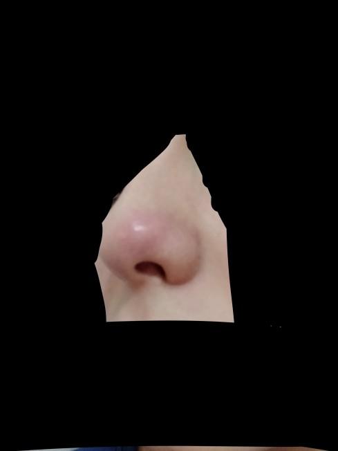 Burnuma bir şey oldu kabardi böyle ne yapacağım?
