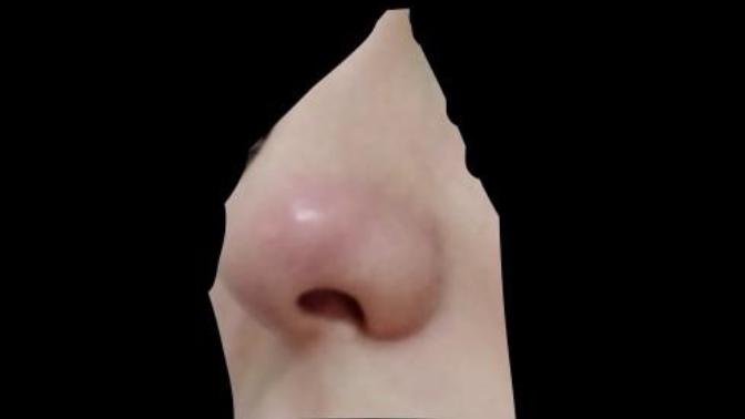 Burnuma bir şey oldu kabardi böyle ne yapacağım?