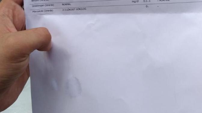 Bu idrar testi sonucu nasıl?