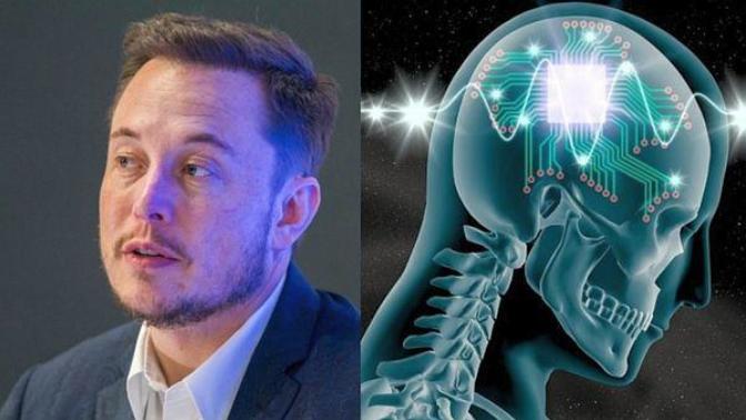 Elon Musk'ın yeni projesi Neuralink! Beyninize çip taktırıp daha donanımlı olmak ister miydiniz?