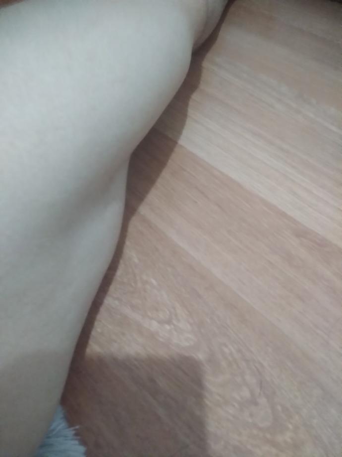 Vücudum çok iğrenç çok kilo verince heryerim sarktı bu genc yaşta spor da düzeltmedi :( ?