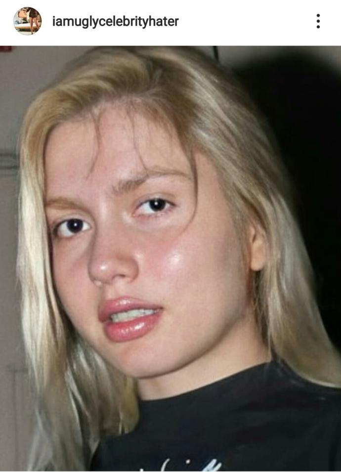 Aleyna tilki hem çirkin hemde sahte sarışın mı?