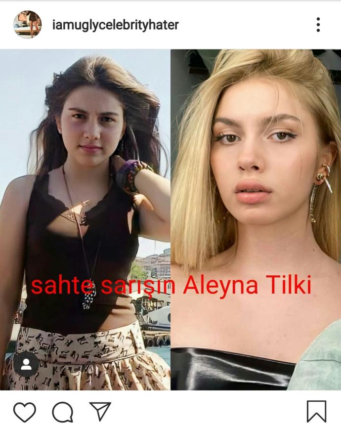solda 13 yaşında sağda 20 yaşında şimdiki hali