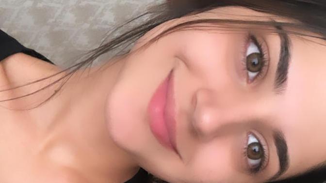 Normalde yüzümde sadece siyah nokta var her ay düzenli cilt bakımı yaptırırım bu defa çok artmış diye baya kötü oldu geçer mi?