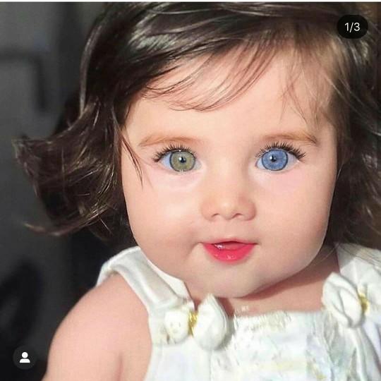 Heterochromia göze sahip olsanız lens kullanır mıydınız, yoksa bu farklılık sizi özel mi kılardı?