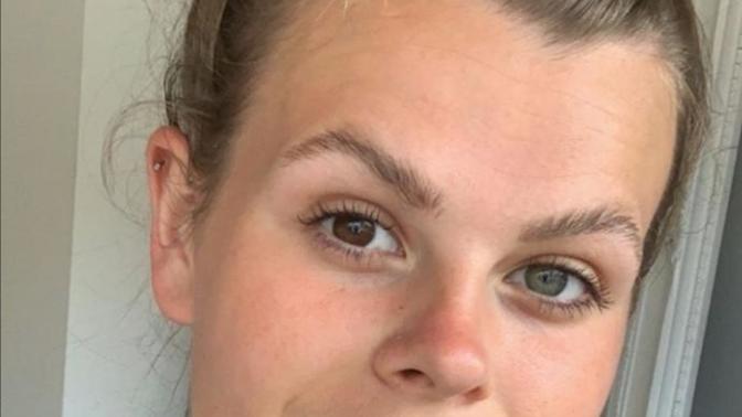 Heterochromia göze sahip olsanız lens kullanır mıydınız, yoksa bu farklılık sizi özel mi kılardı?