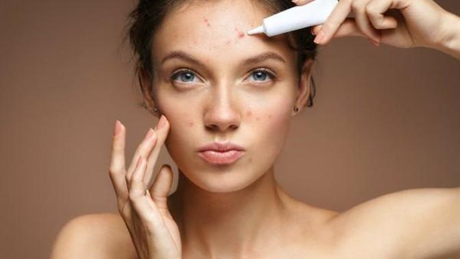 Regl döneminde sivilce oluşumu hangi bölgede daha yoğun olur?