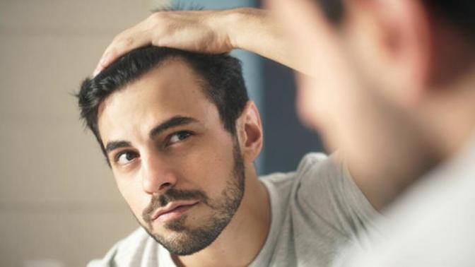 Erkek saç dökülmesine çözüm önerileriniz var mı?