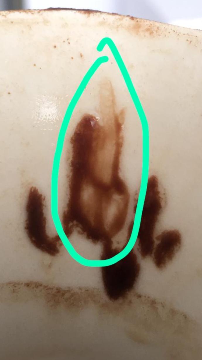 FALIMDA PENİS ÇIKTI ANLAMI NEDİR?