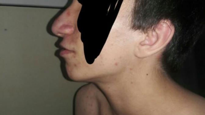 Burnum nasıl çirkin mi kötü mü?