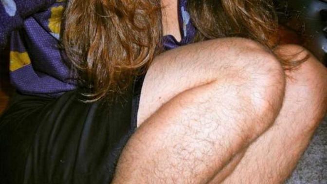 Vücutta tüylerin çok veya az çıkması genetik faktörlerden mi kaynaklıdır?