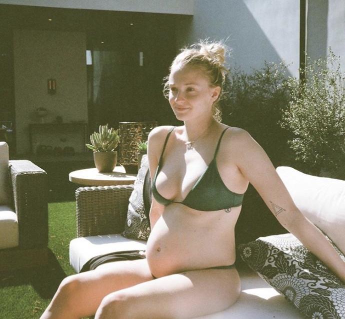 2020 hamilelik yılı oldu! Hangi ünlü güzele hamilelik çok yakışmış🤰 ?