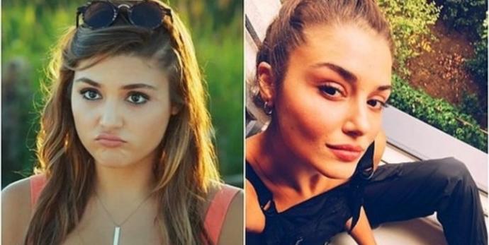 Hande erçel sizce abartılıyor mu? Yüzünde estetik veya bir işlem varmıdır?