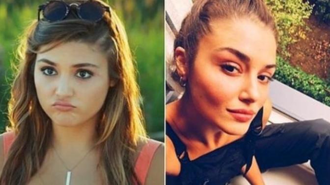 Hande erçel sizce abartılıyor mu? Yüzünde estetik veya bir işlem varmıdır?