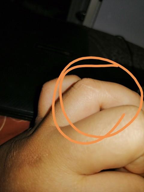Elinize hiç dikiş attılarmı?