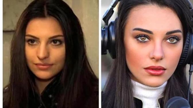 Estetik en çok kime yakışmış?